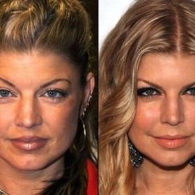 Celebrity a jejich tajné plastiky nosu Celebrity a jejich tajné plastiky nosu