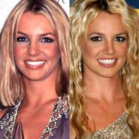 Celebrity a jejich tajné plastiky nosu Celebrity a jejich tajné plastiky nosu
