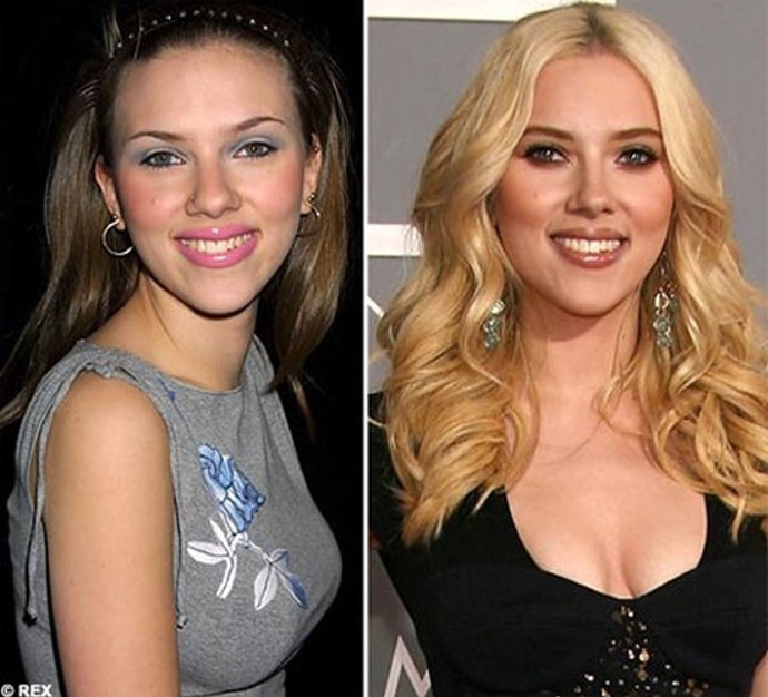 Celebrity a jejich tajné plastiky nosu