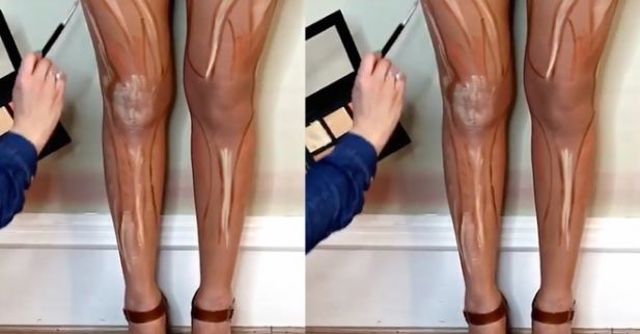 legcontouring 54d68 legcontouring 54d68