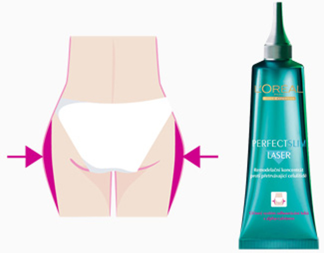 L´Oréal Perfect Slim Laser L´Oréal Perfect Slim Laser
