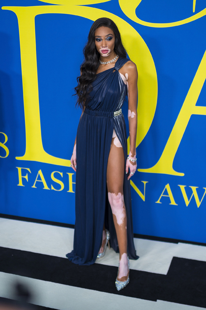 Winnie Harlow v modelu Tommy Hilfiger
