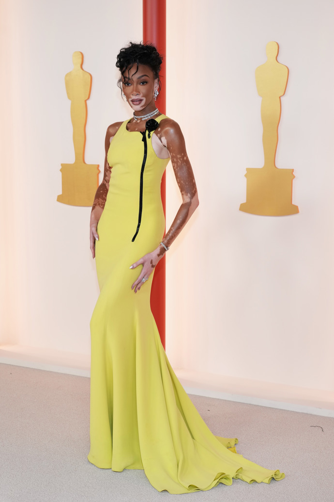 Winnie Harlow
