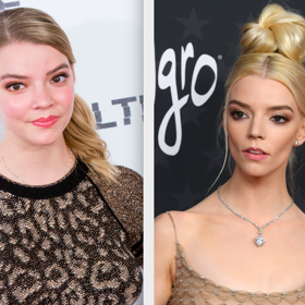 Anya Taylor-Joy
„Jeden z nejvýraznějších zákroků, které podstoupila, je bichectomie, která jí hodně změnila rysy obličeje, dále také výplň lícních kostí. Má za sebou také plastickou operaci nosu, aby působil užší. Znatelný je také browlift, pouze těžko říci, jestli pomocí botulotoxinu nebo nitového liftingu,“ kometuje MUDr. Zuzana Macko
Anya Taylor-Joy
„Jeden z nejvýraznějších zákroků, které podstoupila, je bichectomie, která jí hodně změnila rysy obličeje, dále také výplň lícních kostí. Má za sebou také plastickou operaci nosu, aby působil užší. Znatelný je také browlift, pouze těžko říci, jestli pomocí botulotoxinu nebo nitového liftingu,“ kometuje MUDr. Zuzana Macko