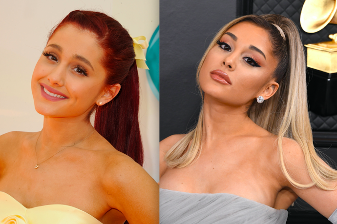 Ariana Grande 

„Vzhled Ariany Grande prošel časem velkou proměnou. Zatímco před lety vypadala jako obyvatelka Latinské Ameriky, dnes připomíná spíše asijskou postavičku z komiksu. Celkově podstoupila rhinoplastiku, tedy plastickou úprau nosu. Viditelná je také konturace spodní části obličeje (konkrétně čelisti a brady), výplň rtů a ponytail lift. Pravděpodobně provedený chirurgickou metodou, díky kterému má zdvednuté obočí a čelo.“
