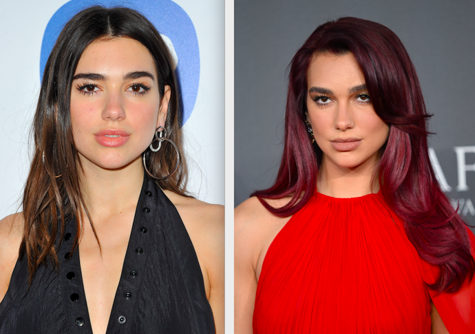 Dua Lipa


„Podstoupila očividně více chirurgických zákroků, které jí změnily rysy v obličeji. Dále má výplň rtů a velkou změnu také udělala výplň brady a aplikace botulotoxinu,“ vypočítává MUDr. Macko

