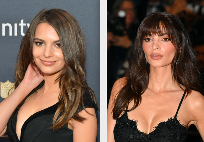Emily Ratajkowski


„Podstoupila mnoho zákroků v rámci estetické dermatologie a plastické chirurgie, která jí razantně změnila tvar obličeje. Dále vidím výplň rtů, výplň lícních kostí a kontur čelisti. Díky plastické operaci nosu, se zvedla jeho špička,“ identifikuje úpravy slavné modelky estetická dermatoložka. 
