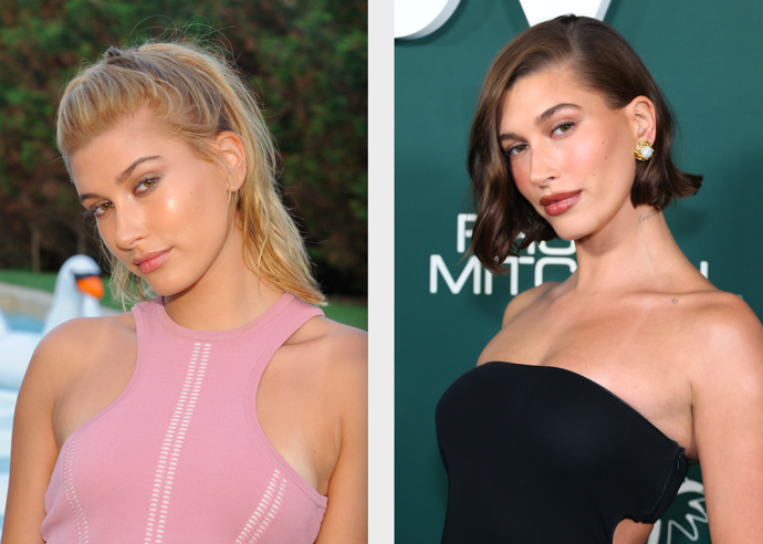 Hailey Bieber


„Jedním z nejvýraznějších zákroků je browlift, který hodně změnil struktury v obličeji a vykouzlil Hailey sexy obočí. Dále podstoupila výplň rtů. Měla hodně nevýrazný horní ret a spodní ret působil asymetricky. Tímto zákrokem dosáhl lékař velmi hezkého efektu. Má za sebou i decentní úpravu nosu a pravděpodobně i jemnou konturaci obličeje kyselinou hyaluronovou.“
