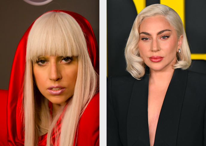 Lady Gaga


„Mezi nejvýraznější zákroky patří určitě rhinoplastika nosu. Její tvář díky tomuto zákroku vypadá rafinovaněji a zároveň se jí srovnal i malý hrbolek. Nos teď působí rovně a hladce. Dále je markantní výplň rtů, brady a lícních kostí. Kromě toho má Lady Gaga udělaný browlift. Dovolím si tvrdit, že všechny výše uvedené úpravy, kterých není právě málo, této celebritě neublížily – naopak jí pomohly zvýraznit její zajímavé rysy obličeje,“ chválí MUDr. Macko
