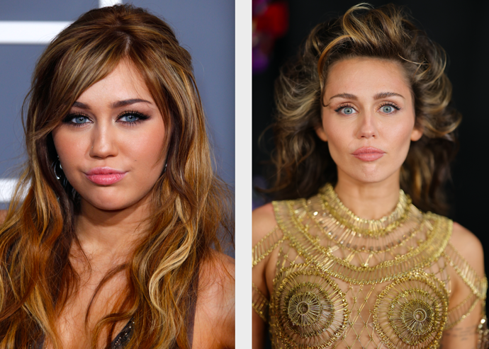 Miley Cyrus


„Prošla mnoha změnami image, včetně několika estetických zákroků. Patří mezi ně například plastika nosu, výplň rtů, browlift a také bichectomie, což je zjednodušeně řečeno odstranění tuku v oblasti tváře.“
