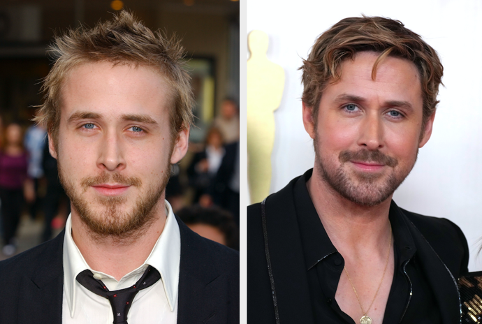 Ryan Gosling

„Udržuje si obličej v báječné formě a dělá to velmi sofistikovaně a přirozeně. Pracuje na kvalitě své pleti hloubkovým čištěním pokožky a také stimulací. Má aplikovaný botulotoxin a pravděpodobně si nechal upravit nos plastickým chirurgem, ale obojí velice přirozeně a uzcela v souladu s jeho vzhledem.“
