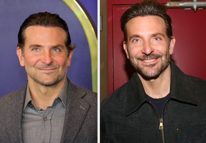 Bradley Cooper


„Podstoupil facelift, který hodně omladil jeho obličej a vrátil ho o několik let zpátky. Dále má určitě v obličeji výplně a také aplikovaný botulotoxinu. Evidentně nezanedbává ani péči o pleť, zřejmě jí dopřává mikrojehličkování.“
