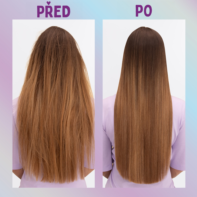 IPL epilátor Braun