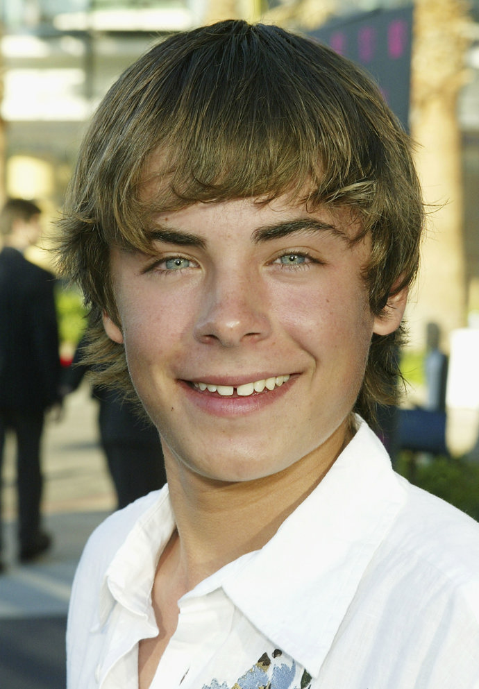  Zac Efron před fazetami 