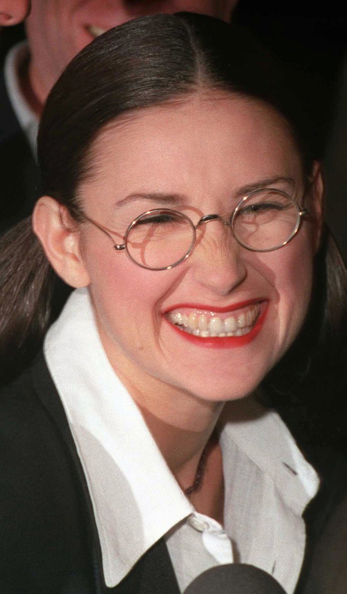  Demi Moore před fazetami 