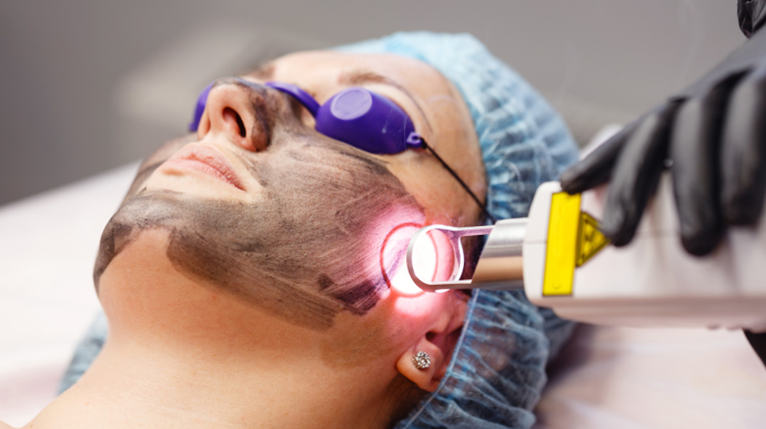  Ošetření na klinice Asklepion - Hollywood Laser Peel