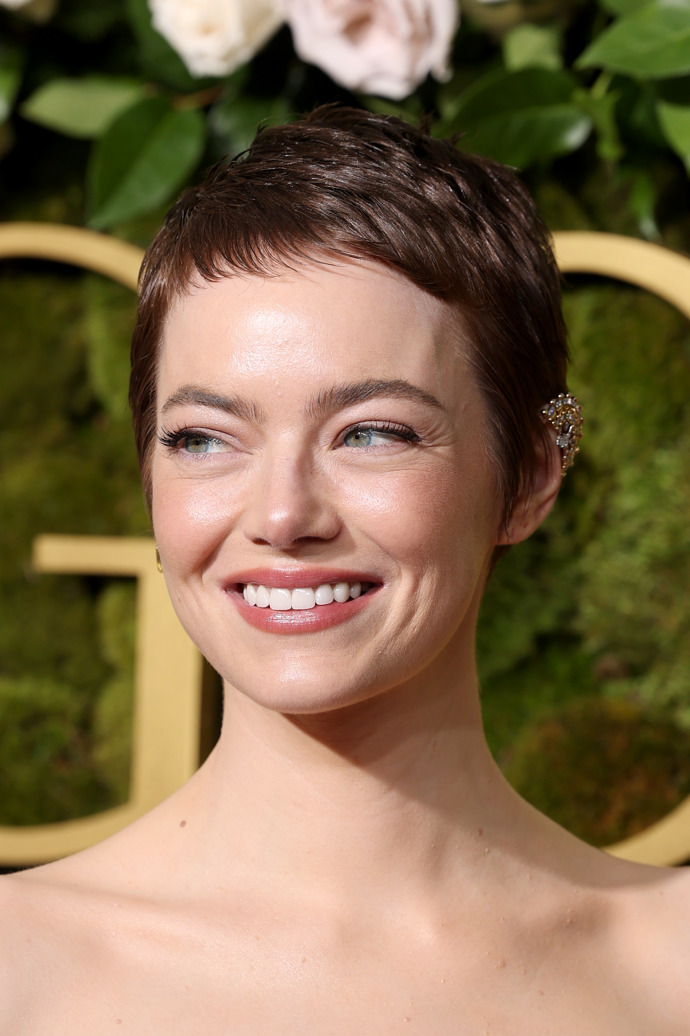  Zubní proměny celebrit - Emma Stone po