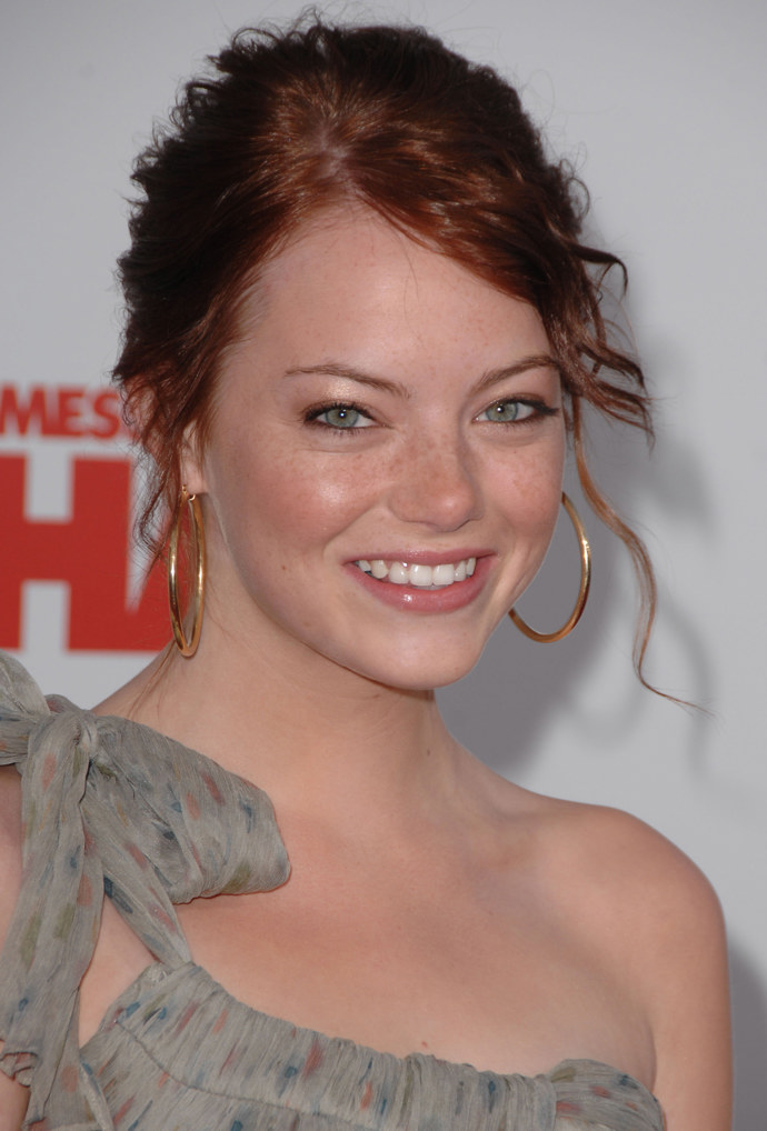  Zubní proměny celebrit - Emma Stone před 
