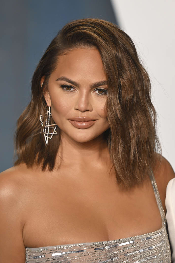  Chrissy Teigen po buccal fat removal