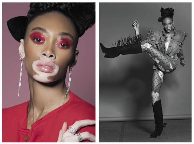 Winnie Harlow: nová tvář krásy Winnie Harlow: nová tvář krásy