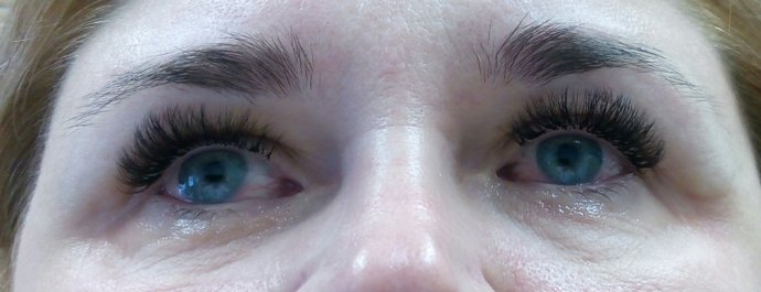 Slzení očí poukazuje na alergii na lepidlo na řasy