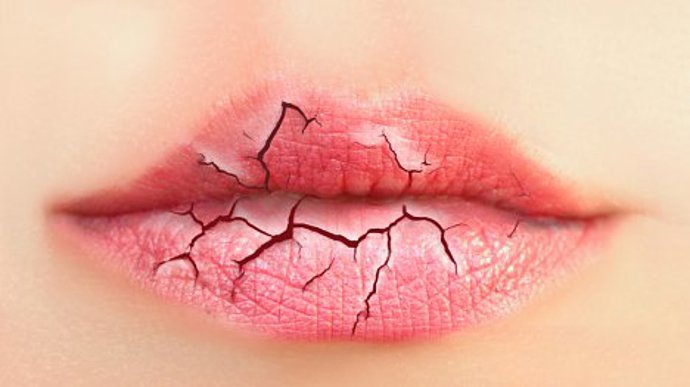 Pokud máte popraskané rty, musíte je hydratovat