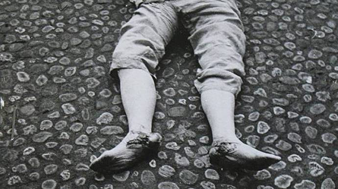 Ministr zahraničí měl zranění neslučitelná se životem