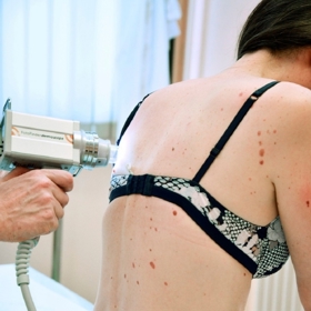 Lékaři mají na kontrolu pih speciální přístroje.