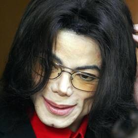 Čím byla Michaelova pleť bělejší, tím mu přibývalo zdravotních problémů.