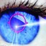 Laserové operace očí se bát nemusíte.