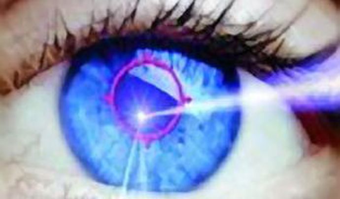 Laserové operace očí se bát nemusíte.