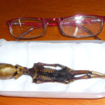 Pět let dlouhé zkoumání kostry - včetně testů DNA - ukázalo, že za neobvyklý tvar a velikost může genetická mutace.