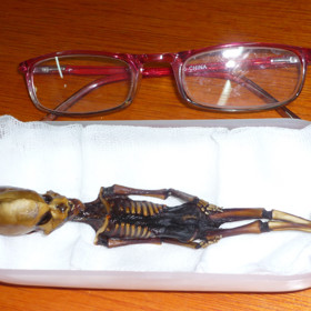 Pět let dlouhé zkoumání kostry - včetně testů DNA - ukázalo, že za neobvyklý tvar a velikost může genetická mutace.