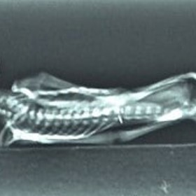 Rentgenový snímek Aty.