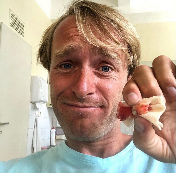 Mediálně se začal prosazovat po svém návratu z Austrálie. Jeho první televizní pořad „Jak na to“ vysílala Česká televize. Stejně tak i dvacetidílný seriál „S Jakubem na rybách“, který se objevil jak na České, tak i Slovenské televizi.