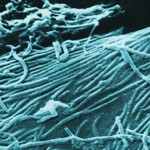 Ebola je virové onemocnění známé také jako krvácivá horečka. Představuje jednu z nejnebezpečnějších nákaz pro lidstvo. Virus ebola se poprvé objevil v roce 1976, dosud největší epidemie eboly propukla na přelomu let 2013 a 2014 v západní Africe.