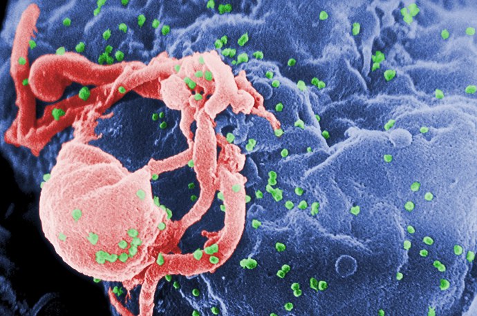 Virus HIV se na člověka přenesl z primátů někdy na počátku 20. století. Může způsobovat nemoc AIDS.