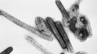 Marburg virus patří mezi velká rizika současnosti, stále je aktivní především v Angole a Ugandě (mortalita dosahuje 87 procent). Virus byl objeven v roce 1967 v Německu, konkrétně v Marburgu. Od opic dovezených na pokusy z Ugandy se tu nakazilo 25 laboratorních pracovníků, dalších 6 lidí včetně lékařů a patologa se nakazilo od nemocných lidí. Sedm osob zemřelo.