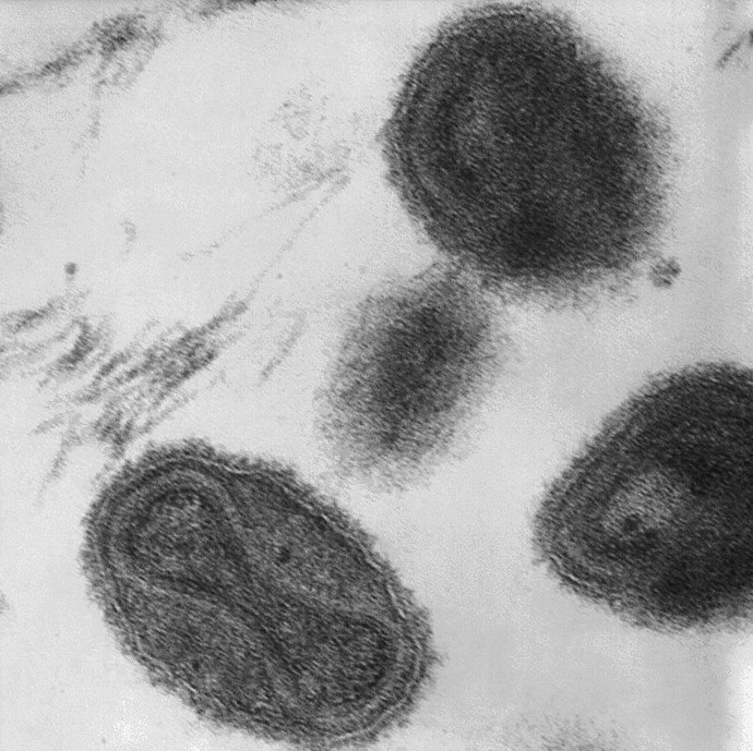 Pravé neštovice byly jedním z nejnebezpečnějších onemocnění vůbec, jen během 20. století zabily na půl miliardy lidí. Od roku 1980 jsou považovány za zcela vymýcené.