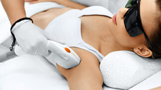 Laserové epilace: Zbavte se chloupků natrvalo. Je vhodná i na obličej či třísla