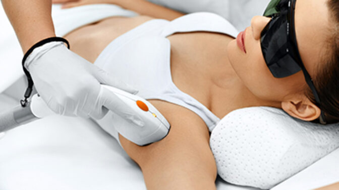 Laserové epilace: Zbavte se chloupků natrvalo. Je vhodná i na obličej či třísla