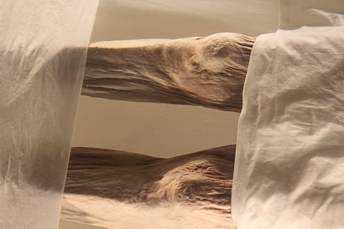 Kůže byla sice zdeformovaná, ale pořád pružná.
