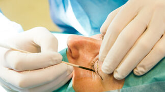 Soutěžte o operaci horních víček na klinice Esthé