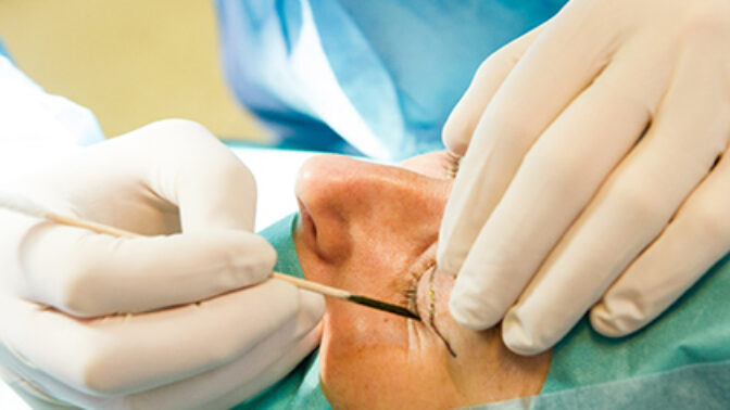 Soutěžte o operaci horních víček na klinice Esthé