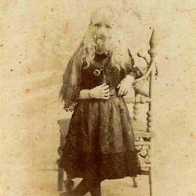 Alice Doherty od mala pózovala fotografům, vydělávala peníze pro sebe i rodinu. Její nemoc, hypertrichóza, jí ale znemožňovala žít jako ostatní děti. Pro malou dívku to muselo být utrpení.