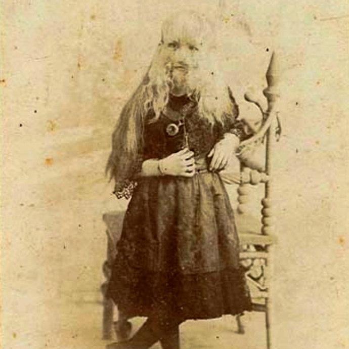 Alice Doherty od mala pózovala fotografům, vydělávala peníze pro sebe i rodinu. Její nemoc, hypertrichóza, jí ale znemožňovala žít jako ostatní děti. Pro malou dívku to muselo být utrpení.