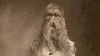 Vlčí dívka Alice Doherty: Jako hříčku přírody ji za peníze předváděli vlastní rodiče