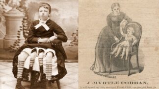 Myrtle Corbinová se narodila s postižením, které se hned tak nevidí. Ona se přesto postavila osudu