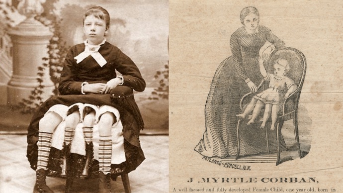 Myrtle Corbinová stíhala vydělávat jako kuriozita v cirkusu, ale také se starat o běžné věci v domácnosti. 