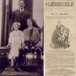 Myrtle Corbinová se vdala a se svým manželem Jamesem Clintonem Bicknellem měla pět dětí. A to i přesto, že jí lékaři nedávali prakticky žádnou naději na normální život. Narodila se totiž se dvěma páry nohou. Kromě toho měla zdvojené i pohlavní orgány...